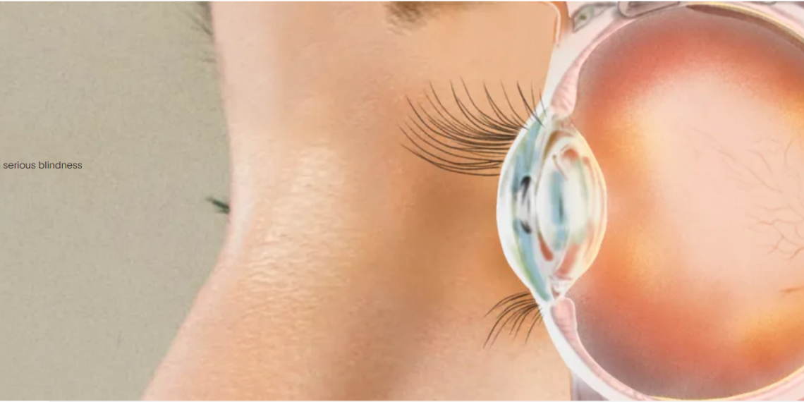 Стартап экс-президента Neuralink создал глазной имплантат Science Eye для лечения слепоты