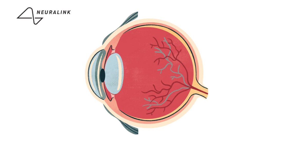 Глазной имплант Blindsight от Neuralink позволит видеть в инфракрасном и ультрафиолетовом диапазонах